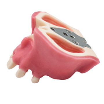 Jingle JG-Y11 — Фантомная модель челюсти с верхнечелюстной пазухой