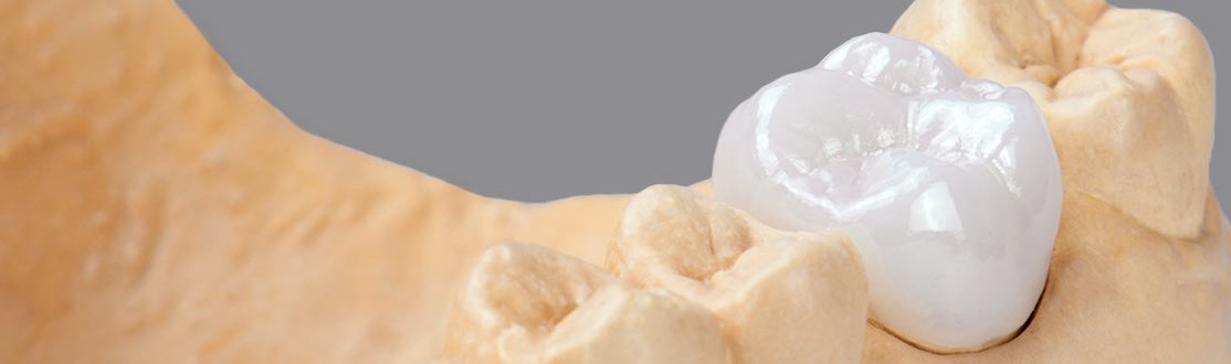 Фрезерная установка Roland DWX-52D без ПО 1.jpg