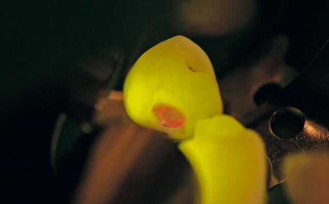 SIROInspect - ультрафиолетовый кариес-детектор 6.jpg