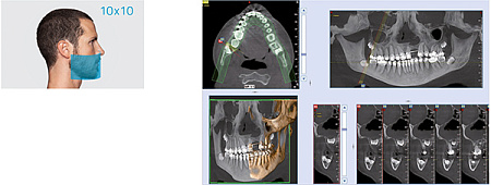 NewTom 2D/3D GO – Компьютерный томограф