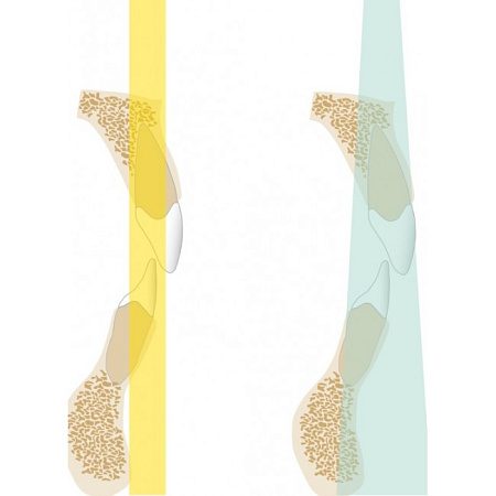 KaVo Pan eXam Plus 3D - цифровая панорамная рентгенодиагностическая система с функцией 3D-томографии 6x8 см и возможностью дооснащения модулем цефалостата