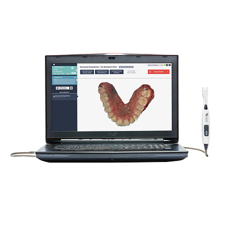 Condor - интраоральный сканер