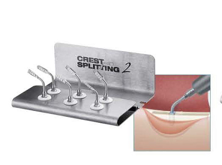 Acteon CrestSplitting II Full – набор насадок (CS1 II, CS2 II, CS3 II, CS4 II, CS5 II, CS6 II) для Piezotome II